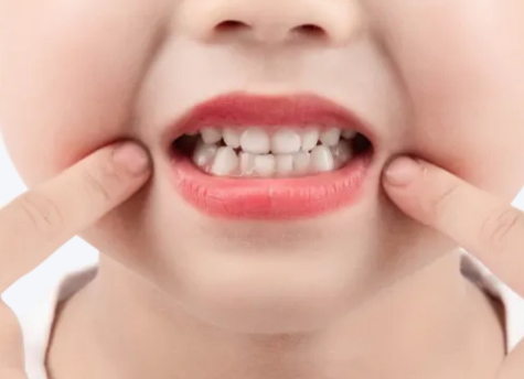 涂氟后多久能刷牙？河北惟德口腔醫(yī)生專業(yè)答疑