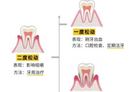 老年人牙齒松動了要怎么辦？