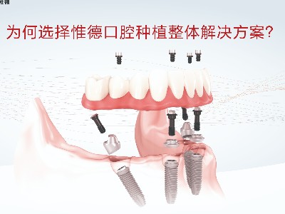 承德老人半口牙齒缺失怎么修復(fù)