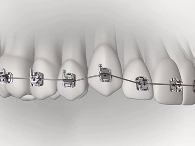 承德市哪家口腔醫(yī)院口腔正畸做得好？惟德口腔醫(yī)院來(lái)告訴您