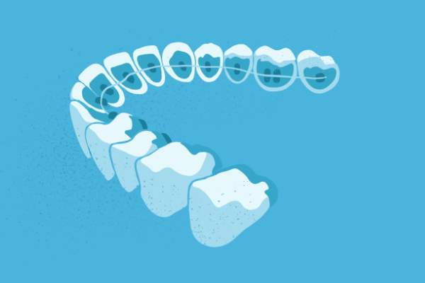 惟德口腔醫(yī)院口腔正畸好不好？